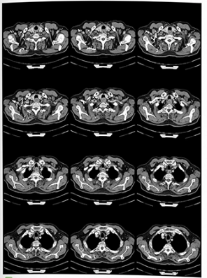 DicomPrint booklet output
